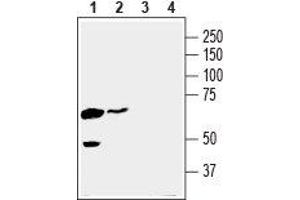 Western blot analysis of human K562 chronic myelogenous leukemia cell line lysate (lanes 1 and 3) and human MDA-MB-231 breast adenocarcinoma cell line lysate (lanes 2 and 4): - 1,2. (SLC16A3 抗体  (C-Term, Intracellular))