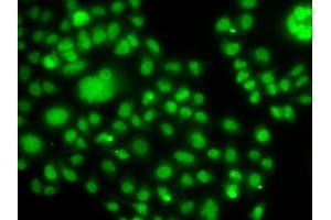 Immunofluorescence analysis of MCF-7 cells using SOX14 antibody (ABIN6130911, ABIN6148290, ABIN6148292 and ABIN6217756).