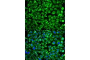 Immunofluorescence analysis of A-549 cells using S antibody . (SAT2 抗体  (AA 1-170))
