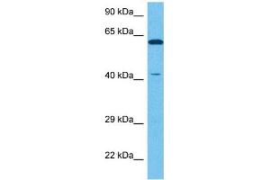 Host:  Rabbit  Target Name:  NR2E1  Sample Tissue:  Human NCI-H226 Whole Cell  Antibody Dilution:  1ug/ml (NR2E1 抗体  (N-Term))