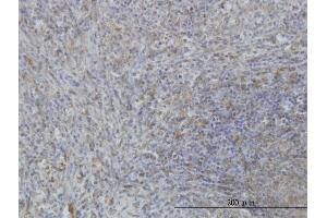 Immunoperoxidase of monoclonal antibody to MARCKS on formalin-fixed paraffin-embedded human spleen. (MARCKS 抗体  (AA 2-65))