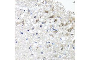 Immunohistochemistry of paraffin-embedded rat brain using METTL20 antibody at dilution of 1:100 (x40 lens). (METTL20 抗体)
