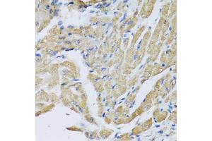 Immunohistochemistry of paraffin-embedded mouse heart using CRHBP antibody (ABIN5973945) at dilution of 1/100 (40x lens). (CRHBP 抗体)
