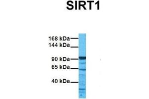 Host:  Rabbit  Target Name:  SIRT1  Sample Tissue:  Human 786-0  Antibody Dilution:  1. (SIRT1 抗体  (N-Term))
