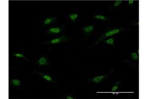Immunofluorescence of monoclonal antibody to ATF2 on HeLa cell.