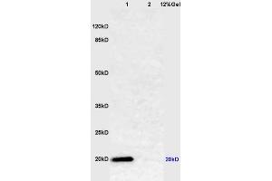 Lane 1: mouse lung lysates Lane 2: mouse muscle lysates probed with Anti Caveolin-1 Polyclonal Antibody, Unconjugated (ABIN686752) at 1:200 in 4 °C. (Caveolin-1 抗体  (AA 2-120))
