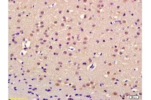 Formalin-fixed and paraffin embedded rat brain labeled with Anti-Thrap3/TRAP150 Polyclonal Antibody, Unconjugated  at 1:200 followed by conjugation to the secondary antibody and DAB staining (THRAP3 抗体  (AA 631-730))