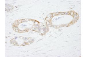 Immunohistochemistry (IHC) image for anti-Ubiquitin Specific Peptidase 3 (USP3) (AA 471-521) antibody (ABIN7449030) (USP3 抗体  (AA 471-521))