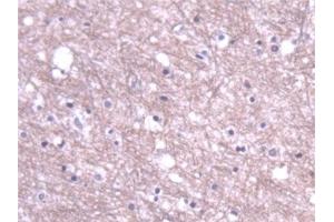 Immunohistochemistry (IHC) image for anti-Protein Phosphatase 1, Catalytic Subunit, alpha Isoform (PPP1CA) (AA 2-330) antibody (ABIN7444715)