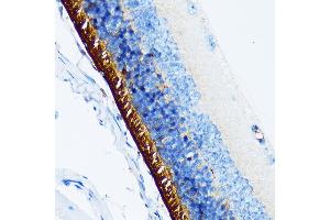 Immunohistochemistry of paraffin-embedded mouse retina using Rhodopsin Rabbit mAb (ABIN7269974) at dilution of 1:100 (40x lens). (Rho-related GTP-binding protein 抗体)
