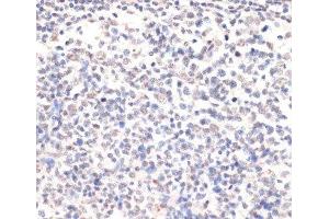 Immunohistochemistry of paraffin-embedded Human placenta using Phospho-Jak2(Y1007/1008) Polyclonal Antibody at dilution of 1:200 (40x lens). (JAK2 抗体  (pTyr1007, pTyr1008))