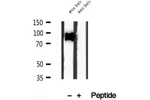 Western blot analysis of extracts of mouse brain tissue, using SEC5/EXOC2 antibody. (EXOC2 抗体  (N-Term))