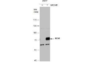 WB Image BCHE antibody detects BCHE protein by western blot analysis. (Butyrylcholinesterase 抗体)