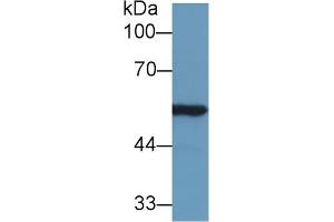 Western Blot; Sample: Rat Kidney lysate; Primary Ab: 1µg/ml Rabbit Anti-Mouse ALDH7A1 Antibody Second Ab: 0. (ALDH7A1 抗体  (AA 29-539))