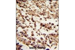 Formalin-fixed and paraffin-embedded human testis tissue reacted with TBP Antibody (C-term), which was peroxidase-conjugated to the secondary antibody, followed by DAB staining. (TBP 抗体  (C-Term))