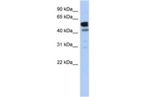 Western Blotting (WB) image for anti-Lactate Dehydrogenase D (LDHD) antibody (ABIN2463930) (LDHD 抗体)