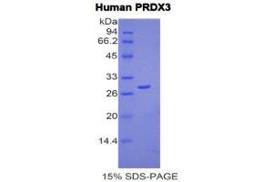 SDS-PAGE (SDS) image for Peroxiredoxin 3 (PRDX3) (AA 5-233) protein (His tag) (ABIN1878519) (Peroxiredoxin 3 Protein (PRDX3) (AA 5-233) (His tag))