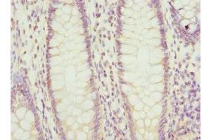 Immunohistochemistry (IHC) image for anti-Prostaglandin E Synthase 2 (PTGES2) (AA 88-377) antibody (ABIN7164852)