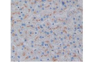 Detection of HO1 in Human Liver Tissue using Monoclonal Antibody to Heme Oxygenase 1 (HO1)