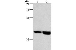 Western Blot analysis of Mouse heart and liver tissue using GPR182 Polyclonal Antibody at dilution of 1:1000 (G Protein-Coupled Receptor 182 抗体)