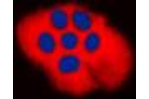 Immunofluorescent analysis of CD256 staining in H9C2 cells.