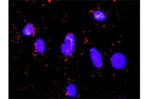 Proximity Ligation Analysis of protein-protein interactions between GSK3B and FOXO1. (FOXO1 抗体  (AA 556-655))
