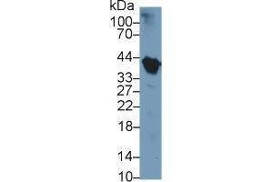 Western Blotting (WB) image for anti-Haptoglobin (HP) (AA 123-307) antibody (ABIN7432676)
