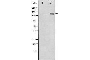 Western blot analysis of Integrin beta3 expression in HepG2 whole cell lysates,The lane on the left is treated with the antigen-specific peptide. (Integrin beta 3 抗体  (C-Term))