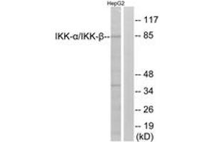 Western blot analysis of extracts from HepG2 cells, using IKK-alpha/beta (Ab-180/181) Antibody. (IKK-alpha /IKK-beta 抗体  (AA 141-190))