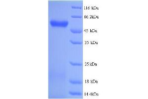 SDS-PAGE (SDS) image for Hyaluronidase-2 (HYAL2) (AA 21-448) protein (His tag) (ABIN5714322)