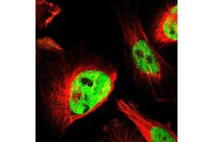 Immunofluorescent staining of U-251 MG with AKAP8 polyclonal antibody  (Green) shows positivity in nucleus but excluded from the nucleoli.