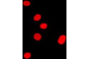 Immunofluorescent analysis of DLX5 staining in Raw264. (DLX5 抗体  (Center))