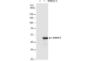 WB Image Ataxin 3 antibody detects Ataxin 3 protein by western blot analysis. (Ataxin 3 抗体)