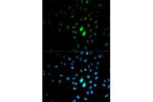 Immunofluorescence analysis of MCF-7 cells using PIN1 antibody. (PIN1 抗体  (AA 1-163))