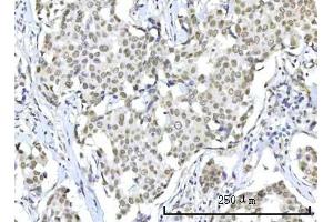 IHC analysis of RBM22 using anti-RBM22 antibody (ABIN7600268).