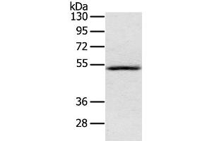 Western Blot analysis of Human normal liver tissue using IL17RB Polyclonal Antibody at dilution of 1:200 (IL17 Receptor B 抗体)