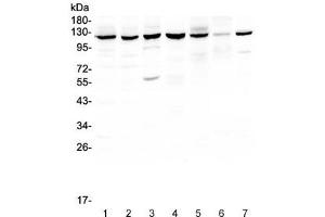 Western blot testing of PARP antibody and Lane 1:  COLO320 (PARP1 抗体  (AA 670-858))