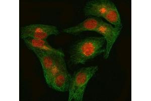 IF analysis of EZH1 using anti-EZH1 antibody (ABIN7601019) and anti-Tubulin Alpha antibody (ABIN7600339). (EZH1 抗体  (AA 27-485))