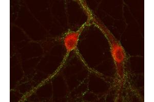 Indirect immunostaining of PFA fixed rat hippocampus neurons with anti-cytohesin 3 (dilution 1 : 500; red) and mouse anti-synapsin 1 (, dilution 1 : 500; green). (Cytohesin 3 抗体  (AA 1-70))