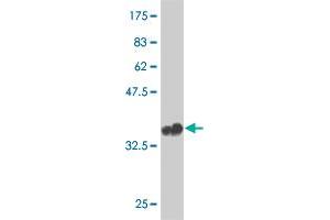 Western Blot detection against Immunogen (36. (SNAP25 抗体  (AA 31-130))