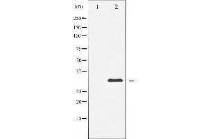 Western blot analysis of S6 Ribosomal Protein expression in serum treated 293 whole cell lysates,The lane on the left is treated with the antigen-specific peptide. (RPS6 抗体  (C-Term))