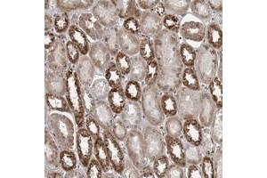 Immunohistochemical staining of human kidney with C17orf70 polyclonal antibody  shows strong cytoplasmic positivity in proximal tubules at 1:50-1:200 dilution. (C17orf70 抗体)