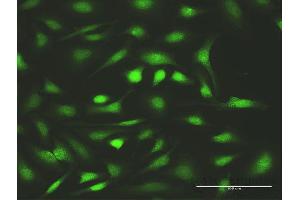 Immunofluorescence of purified MaxPab antibody to FANCC on HeLa cell. (FANCC 抗体  (AA 1-558))