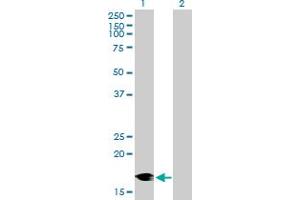 Western Blot analysis of DCTN3 expression in transfected 293T cell line by DCTN3 MaxPab polyclonal antibody. (DCTN3 抗体  (AA 1-176))