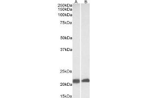 ABIN361198 (0. (Caveolin 3 抗体  (N-Term))