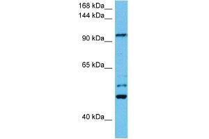 Host:  Mouse  Target Name:  KIF23  Sample Tissue:  Mouse Testis  Antibody Dilution:  1ug/ml (KIF23 抗体  (N-Term))