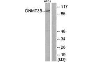 Western blot analysis of extracts from HT-29 cells, using DNMT3B Antibody. (DNMT3B 抗体  (AA 1-50))