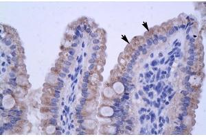 Human Intestine (ZNF358 抗体  (N-Term))