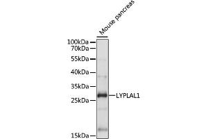 Western blot analysis of extracts of Mouse pancreas, using LYPL antibody (ABIN7268340) at 1:1000 dilution. (LYPLAL1 抗体  (AA 1-100))
