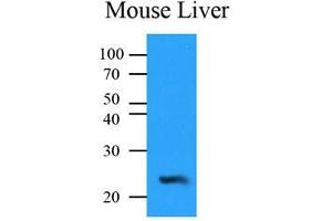 Mouse liver lysates (35 ug) were resolved by SDS-PAGE, transferred to PVDF membrane and probed with anti-human NQO2 (1:500). (NQO2 抗体  (AA 1-231))